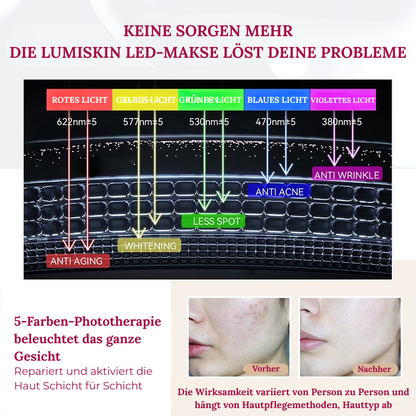 LumiSkin - stahlende Haut mit der LED-Maske