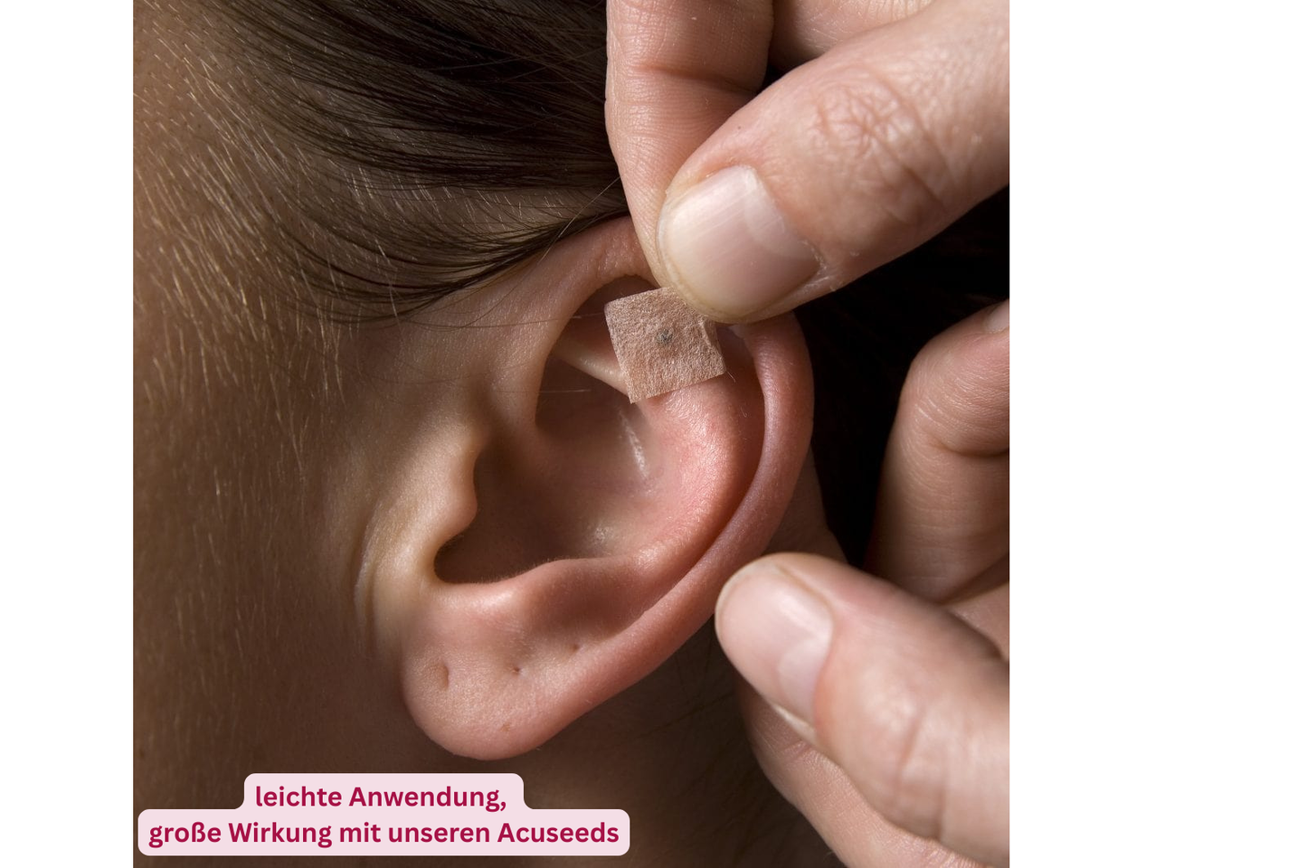 Acuseeds - Ohrakupressur-Samen zur natürlichen Schmerz- und Stresslinderung